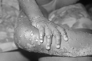 efdf7667-d058-140f-f955-58db48224e2a-95205.jpeg